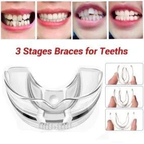 3 Stages Dental Orthodontic Braces Appliance Braces Alignment Trainer Teeth Retainer Bruxism Mouth G